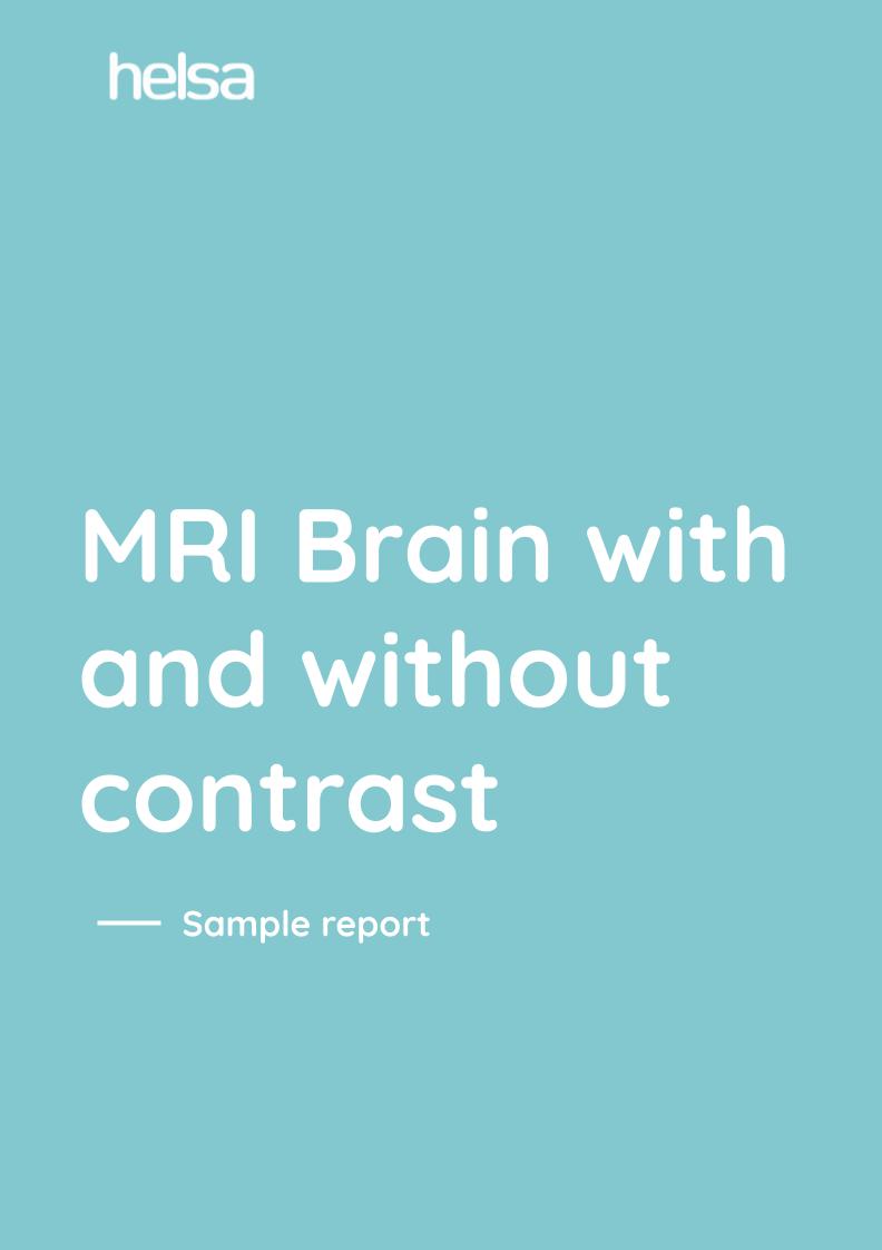 MRI Brain with and without contrast